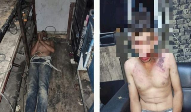 Antalya’da 22 yaşındaki genç işçiye akıl almaz işkence! Dişlerini kerpetenle çekmişler