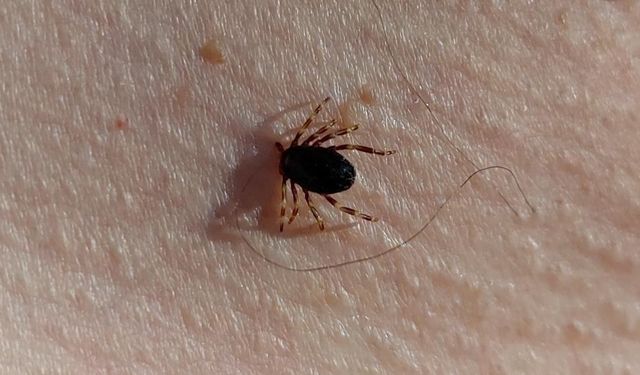 Çorum'da kene ısırması can aldı! - Alaca'da acı kayıp
